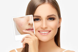 Tea Tree Essential Oil